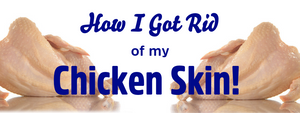 How I Got Rid Of My Chicken Skin