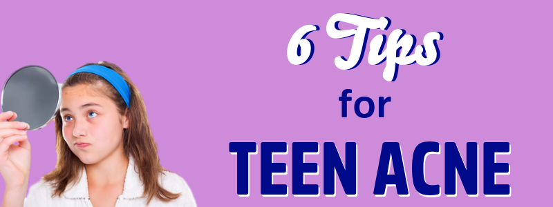 6 Tips for Dealing with Teen Acne