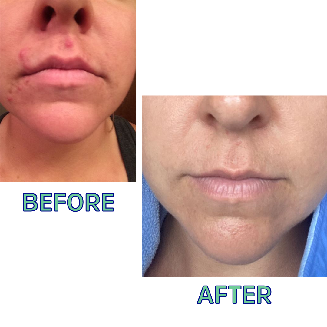 Cleansing Oil For Normal/Combo Skin 2 Oz