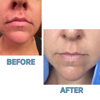 Cleansing Oil For Oily Skin 2 Oz