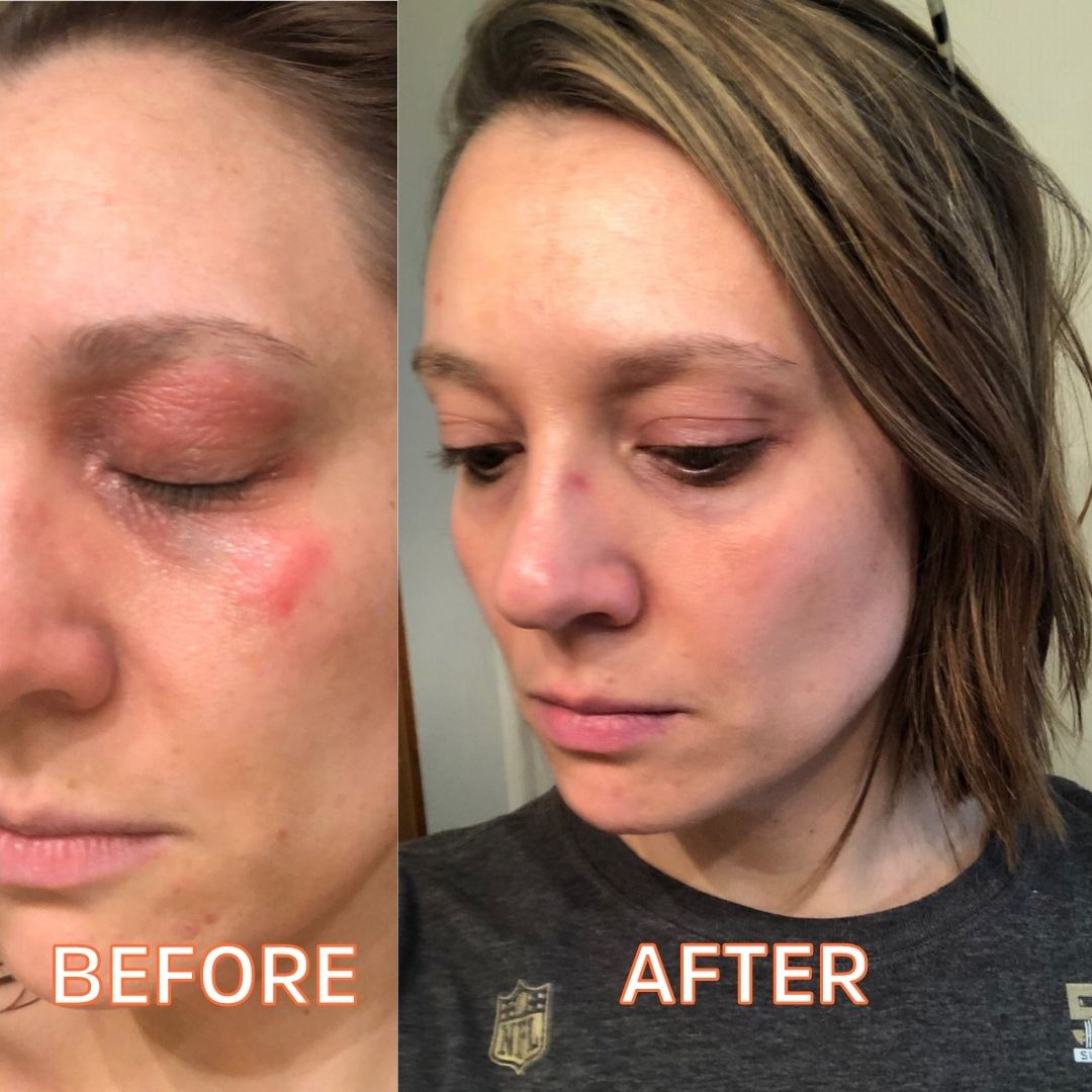 Myrrhaculous Face Cream 1 Oz