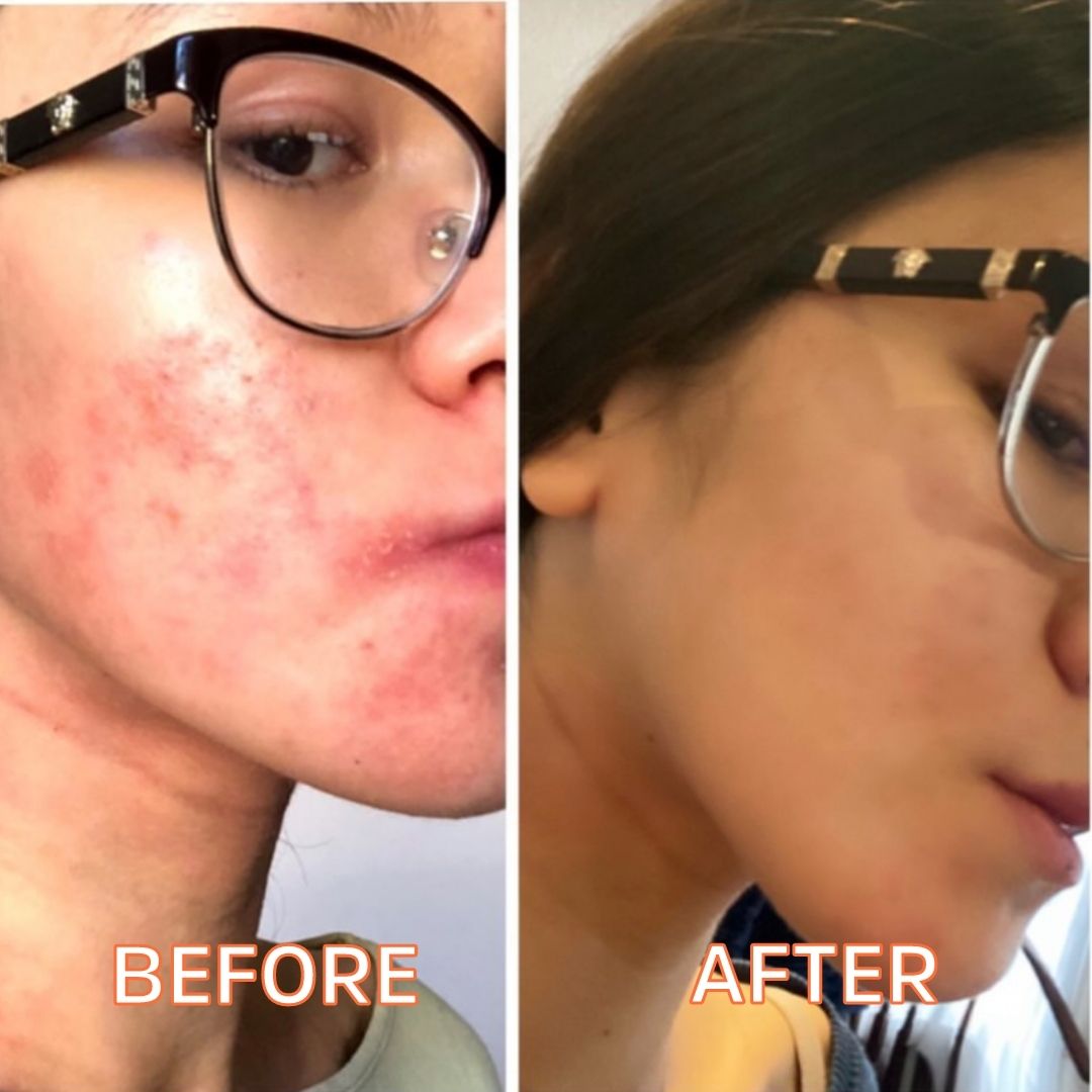 Myrrhaculous Face Cream 1 Oz